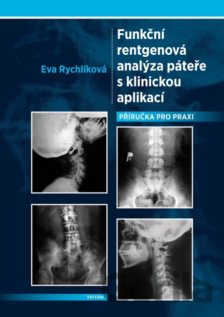 Kniha Funkční rentgenová analýza páteře s klinickou aplikací - Eva Rychlíková