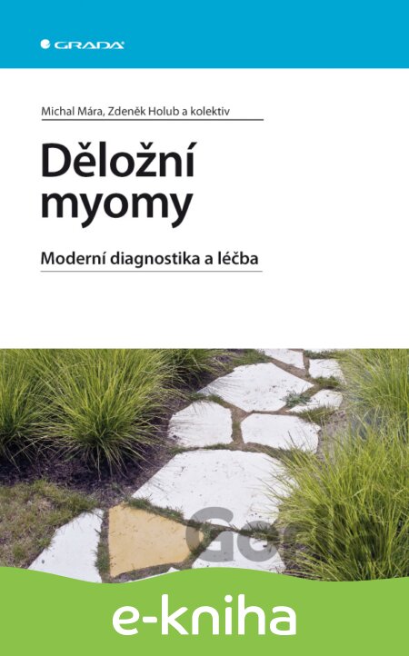 E-kniha Děložní myomy - Michal Mára, Zdeněk Holub, 