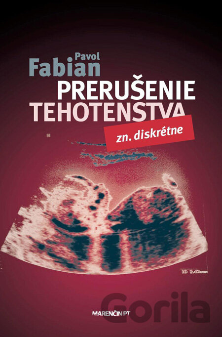Kniha Prerušenie tehotenstva - Pavol Fabian