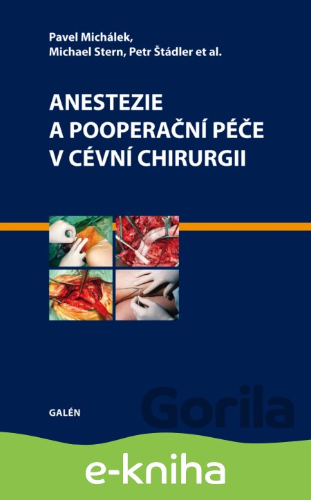 E-kniha Anestezie a pooperační péče v cévní chirurgii - Pavel Michálek, Michael Stern, Petr Štádler