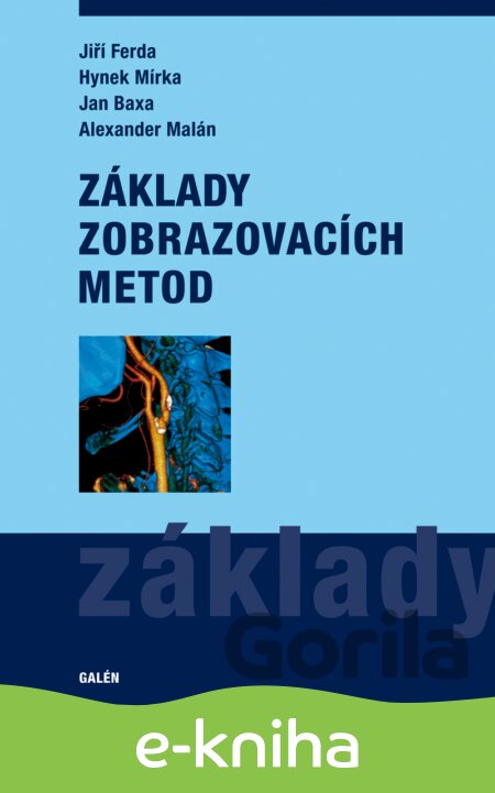 E-kniha Základy zobrazovacích metod - Jiří Ferda, Hynek Mírka, Jan Baxa, Alexander Malán