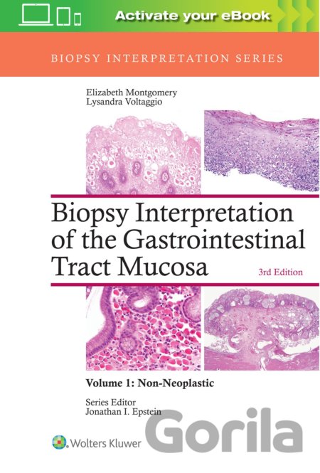 Kniha Biopsy Interpretation of the Gastrointestinal Tract Mucosa - Elizabeth A. Montgomery, Lysandra Voltaggio