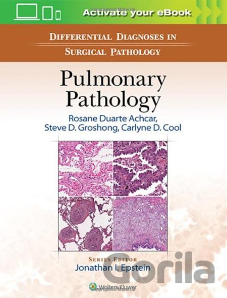 Kniha Differential Diagnosis in Surgical Pathology: Pulmonary Pathology - Rosane Duarte Achcar, Steve D. Groshong, Carlyne D. Cool