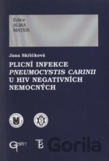 Plicní infekce Pneumocystic carini u HIV negativních nemocných