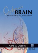 Osborn's Brain: Imaging, Pathology, and Anatomy