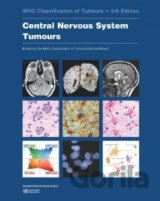 WHO Classification of Tumours: Central Nervous System Tumours