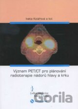 Význam PET/CT pro plánování radioterapie nádorů hlavy a krku
