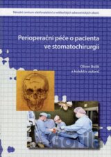 Perioperační péče o pacienta ve stomatochirurgii