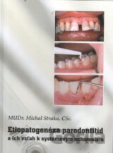 Etiopatogenéza parodontitíd a ich vzťah k systémovým ochoreniam