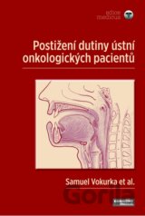 Postižení  dutiny ústní u onkologických pacientů