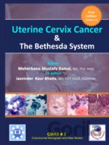 Uterine Cervix Cancer The Bethesda System