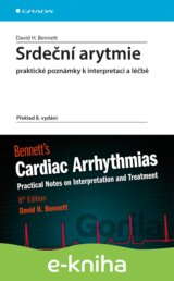 Srdeční arytmie praktické poznámky k interpretaci a léčbě