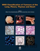 Who Classification of Tumours of the Lung, Pleura, Thymus and Heart