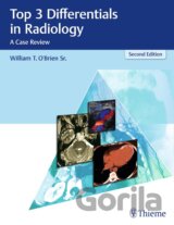 Top 3 Differentials in Radiology: A Case Review