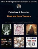 Pathology and Genetics of Head and Neck Tumours