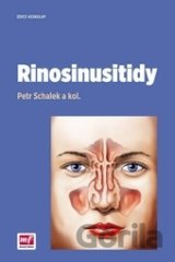 Rinosinusitidy