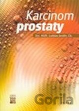 Karcinom prostaty