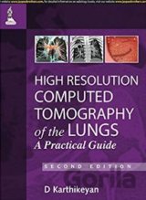 High Resolution Computed Tomography of the Lungs