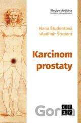 Karcinom prostaty