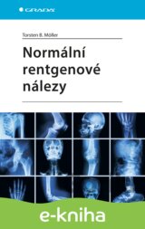 Normální rentgenové nálezy