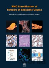 WHO Classification of Tumours of Endocrine Organs