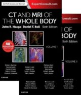 CT and MRI of the Whole Bod, (2 Volume Set)