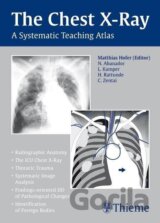 Chest X-ray Trainer