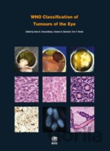 WHO Classification of Tumours of the Eye
