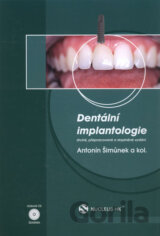 Dentální implantologie