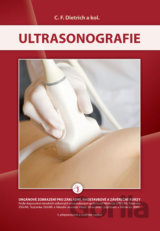 Ultrasonografie
