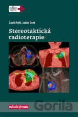 Stereotaktická radioterapie