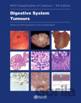 Who Classification of Tumours: Digestive System Tumours