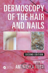 Dermoscopy of the Hair and Nails 2nd Edition