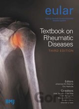 EULAR Textbook on Rheumatic Diseases