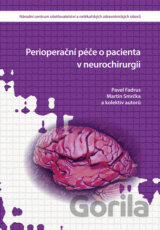 Perioperační péče o pacienta v neurochirurgii