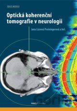 Optická koherenční tomografie v neurologii
