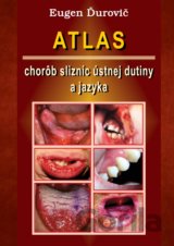 Atlas chorôb slizníc ústnej dutiny a jazyka