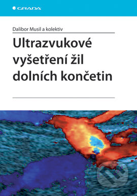 Ultrazvukové vyšetření žil dolních končetin