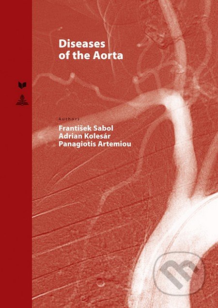 Diseases of the Aorta - František Sabol, Adrian Kolesár, Panagiotis Artemiou