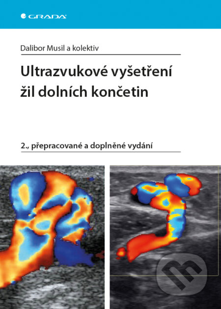 Ultrazvukové vyšetření žil dolních končetin