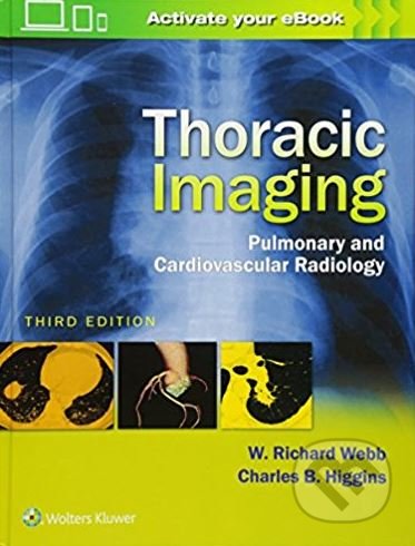 Thoracic Imaging