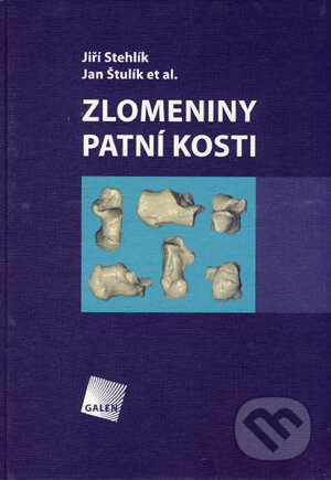 Zlomeniny patní kosti