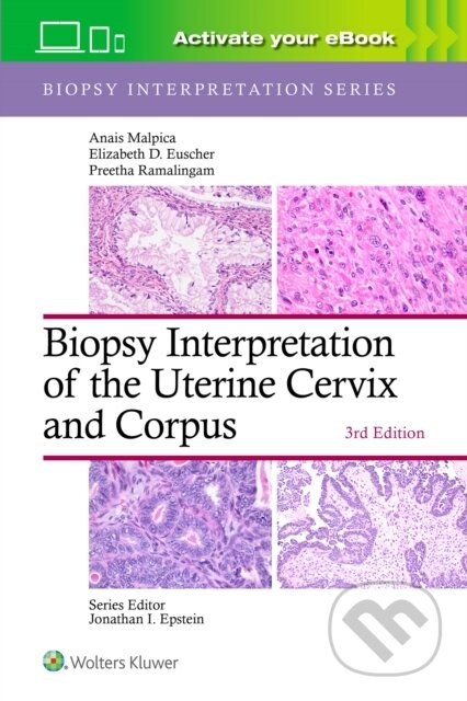 Biopsy Interpretation of the Uterine Cervix and Corpus: Print + eBook with Multimedia