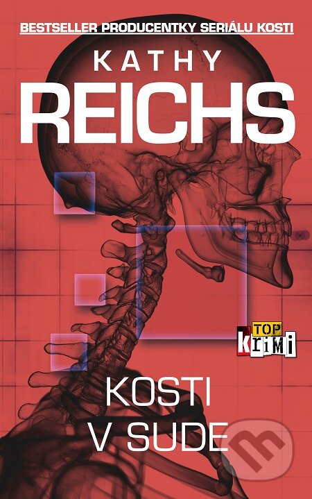 Kosti v sude