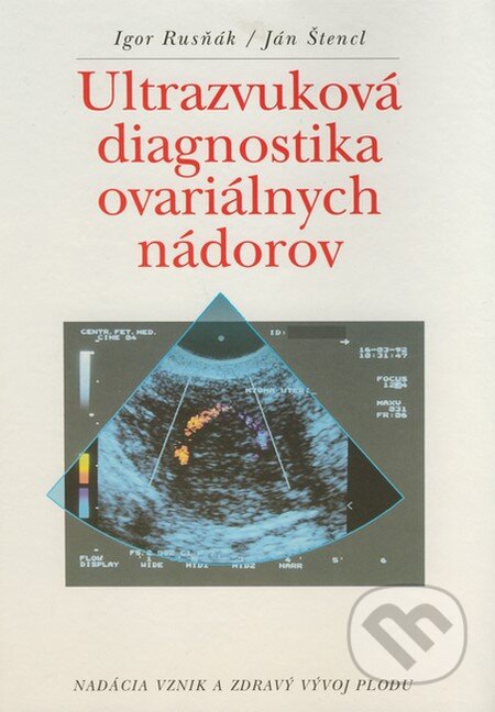Ultrazvuková diagnostika ovariálnych nádorov