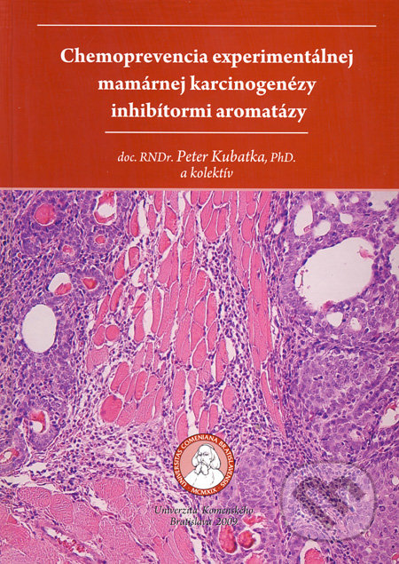 Chemoprevencia experimentálnej mamárnej karcinogenézy inhibítormi aromatázy - Peter Kubatka a kol.