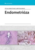 Endometrióza - Jiří Lenz, Radek Chvátal, Luděk Fiala