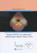 Význam PET/CT pro plánování radioterapie nádorů hlavy a krku - Iveta Kolářová a kolektív
