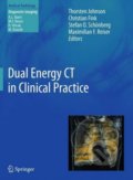 Dual Energy CT in Clinical Practice - Thorsten Johnson a kol.