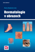 Revmatologie v obrazech - Marta Olejárová